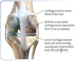 Arthritis in dogs